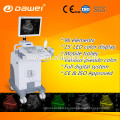 Ecografía del carro de CE &amp; ISO para la ginecología / la obstetricia / la urología y el explorador ultrasónico móvil hechos en la venta caliente de China